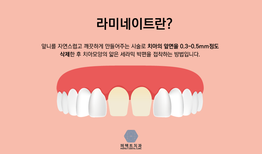 퍼펙트라미네이트!! 관련 이미지 2