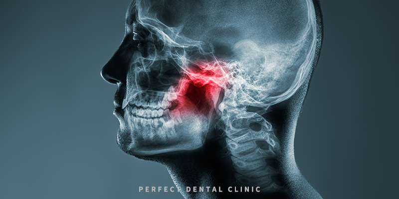 턱관절질환 치아교정 해도 될까? 관련 이미지 2