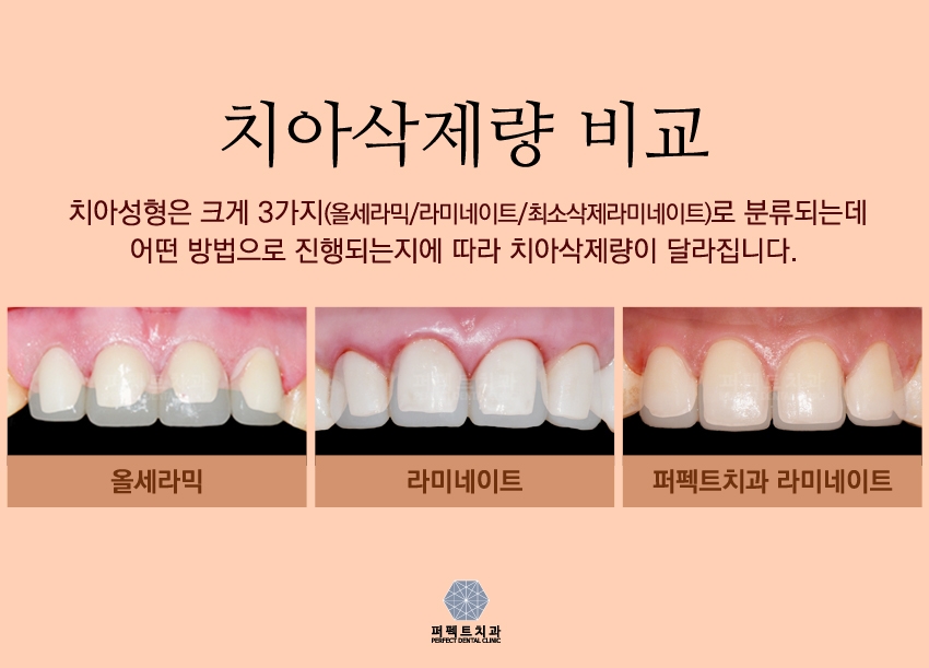 2018년도 마지막 저렴한 라미네이트가격!! 관련 이미지 4