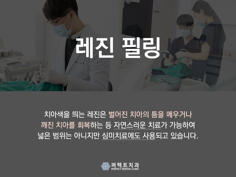 레진필링으로 벌어진 치아 메꾸자 관련 이미지 3