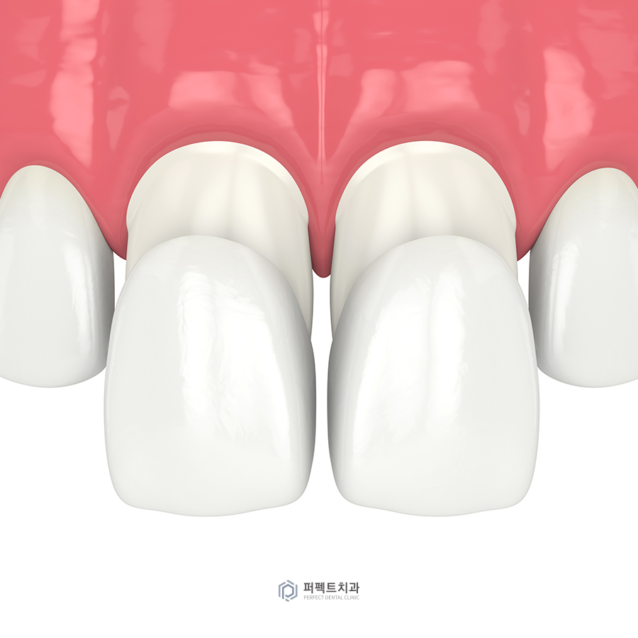 '블랙트라이앵글' 해결 방법은? 관련 이미지 3