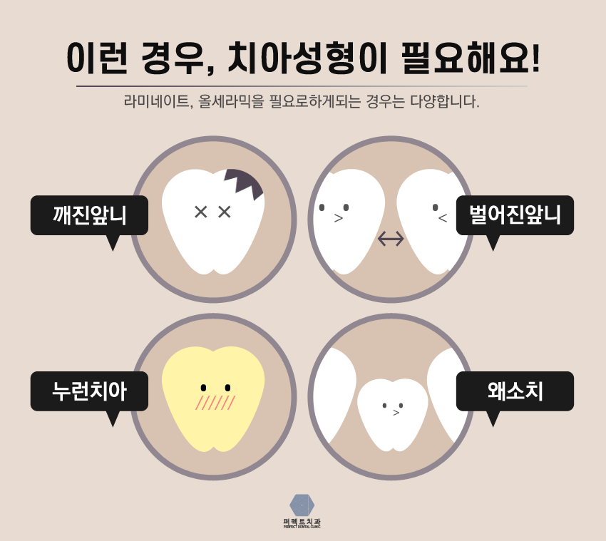 퍼펙트라미네이트!! 관련 이미지 5