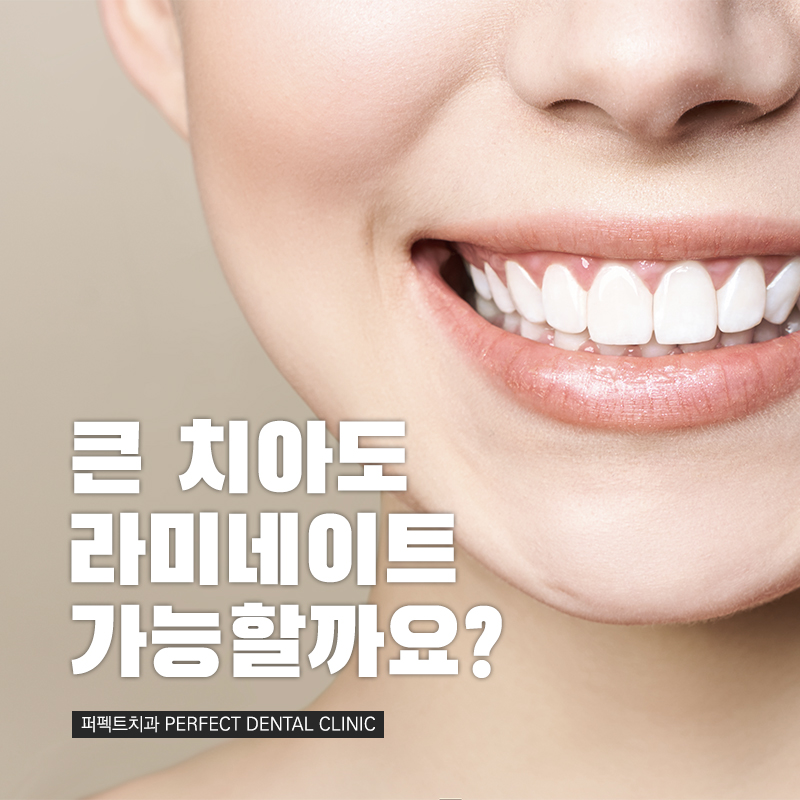 큰 치아도 라미네이트가 가능할까요? 관련 이미지 1