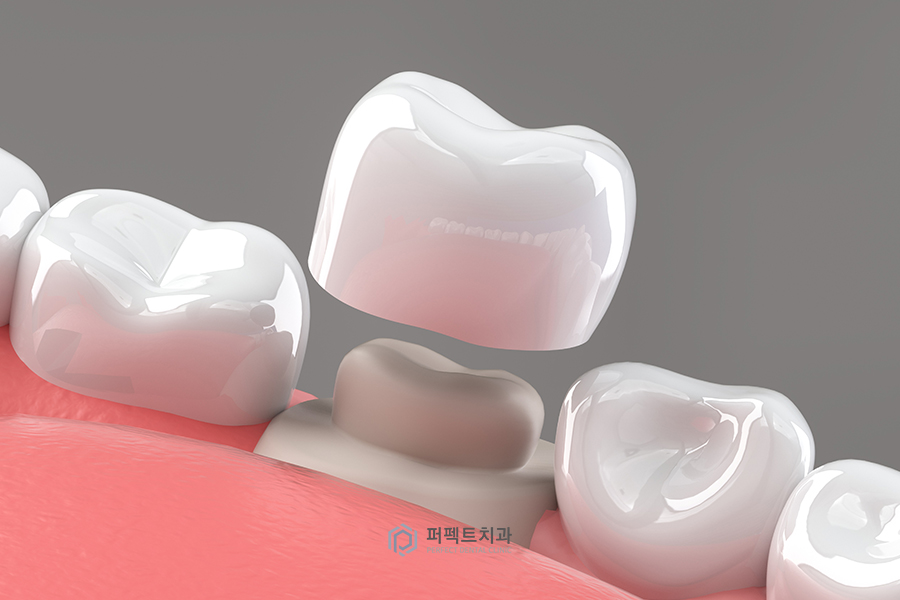 ✨신경치료 질문 BEST② 관련 이미지 1