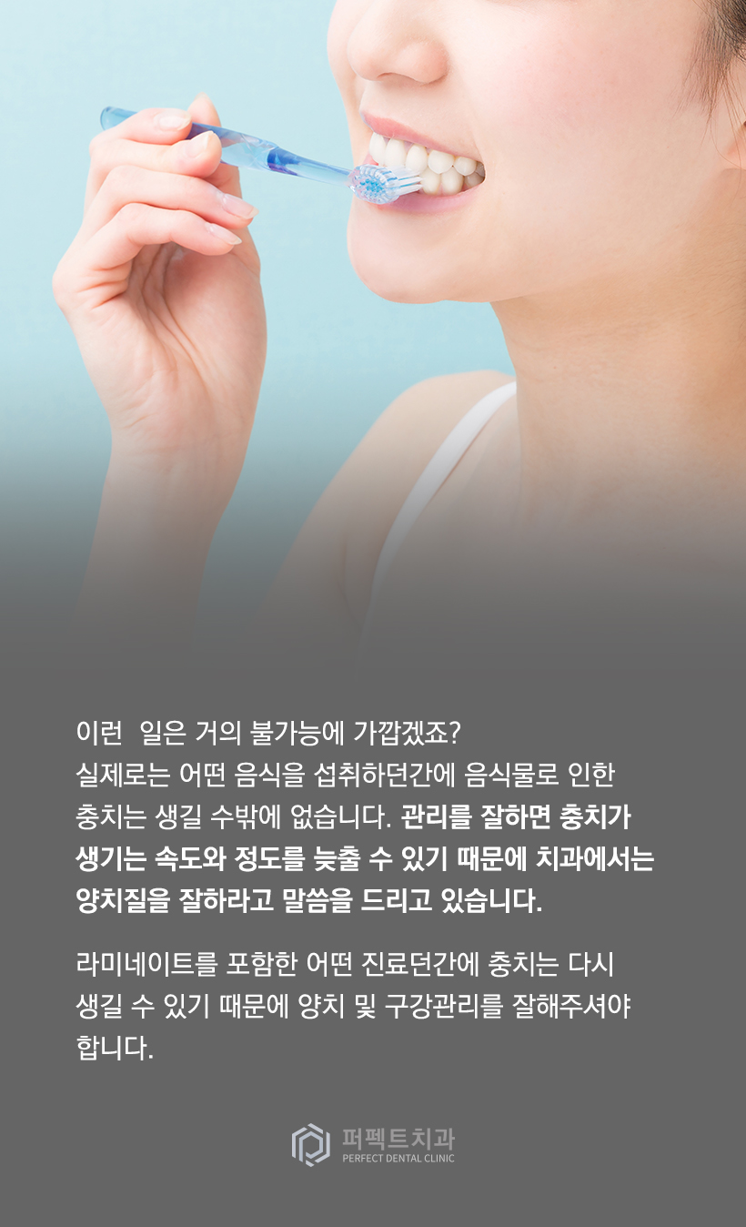 라미네이트에 충치가 생겼다면? 관련 이미지 3