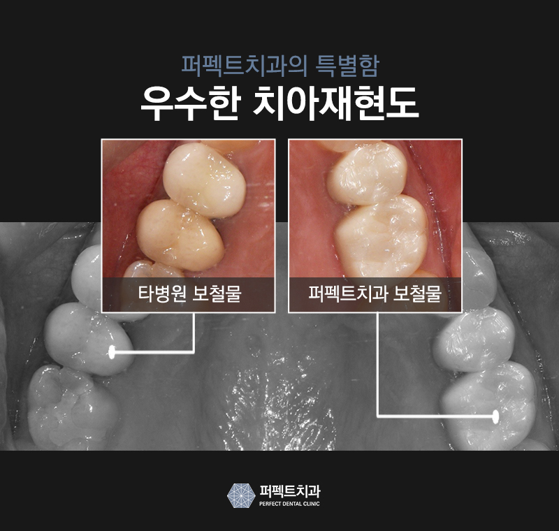 선릉역 치과 추천 확인해보세요! 관련 이미지 5