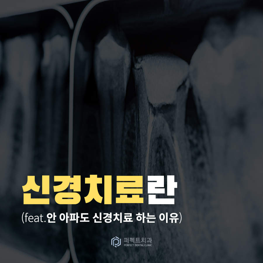 신경치료란 무엇일까요? 관련 이미지 1