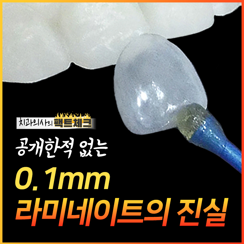 강남역치과 무삭제라미네이트 비용 관련 이미지 1