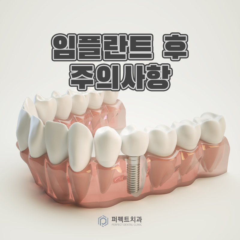 임플란트 수술 후 주의사항은? 관련 이미지 1