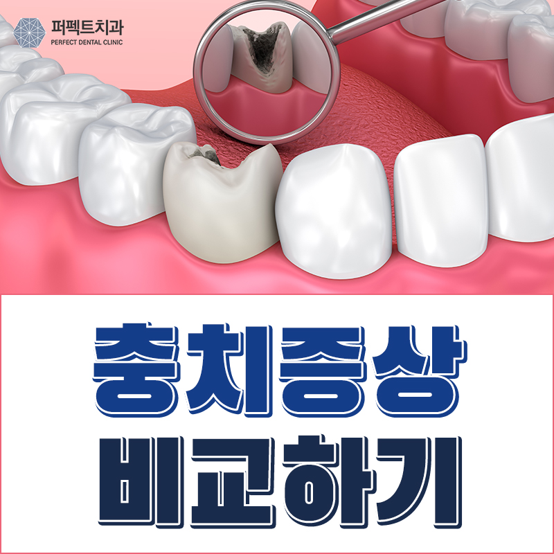 충치 아플때 어떻게? 비용은? 관련 이미지 1