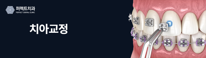 치아교정과 치아성형, 다른 점이 뭘까? 관련 이미지 2