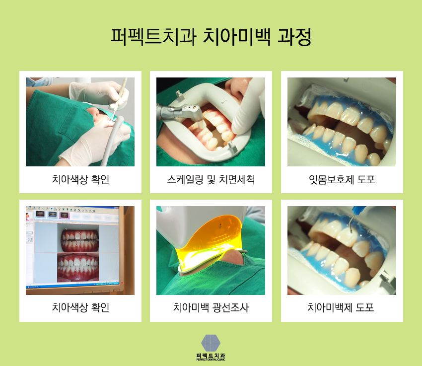 너무 눈이 부셔! 미백했구나! 관련 이미지 7