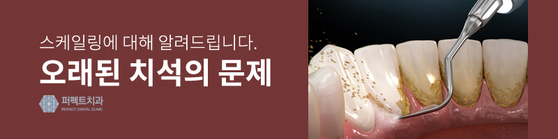 치석 제거는 스케일링으로! 관련 이미지 3