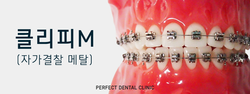 퍼펙트치과 전체교정 비용 궁금해? 관련 이미지 3