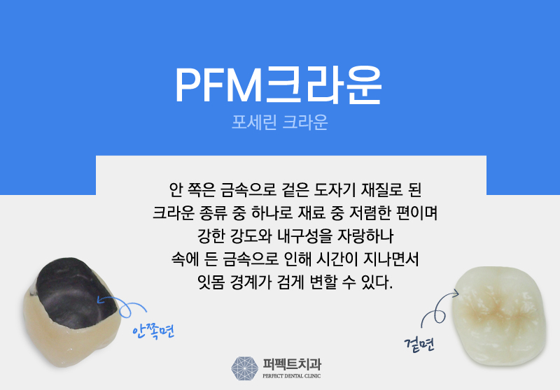 5월 프로모션 진행중인 ▶ 지르코니아 크라운! 관련 이미지 3