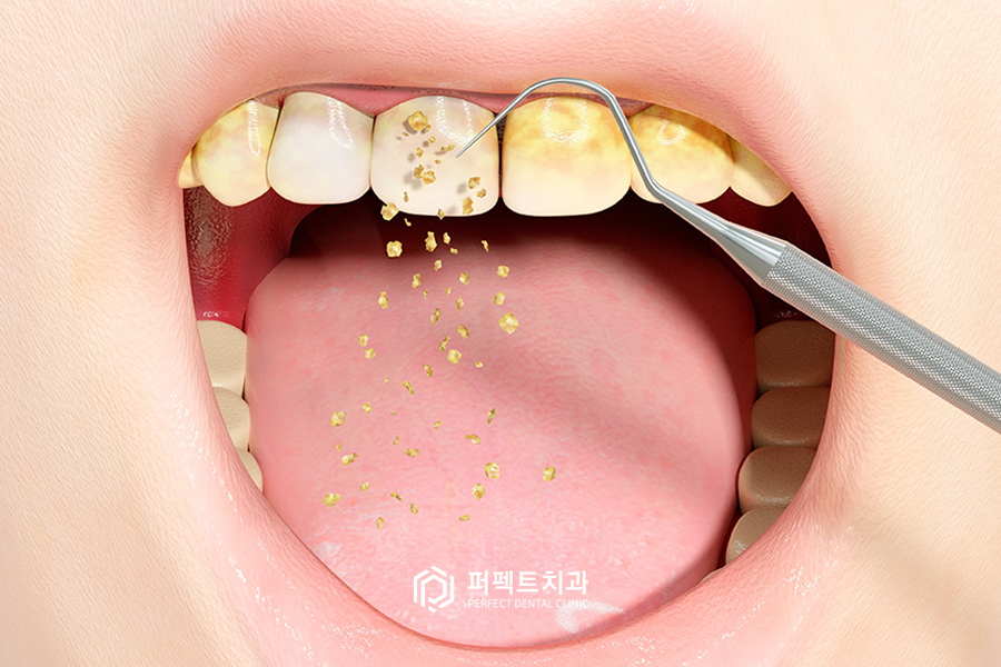 ②스케일링 주기와 비용은? 관련 이미지 1