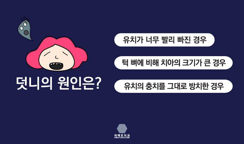 불편한 덧니 심미적으로 교정 관련 이미지 3