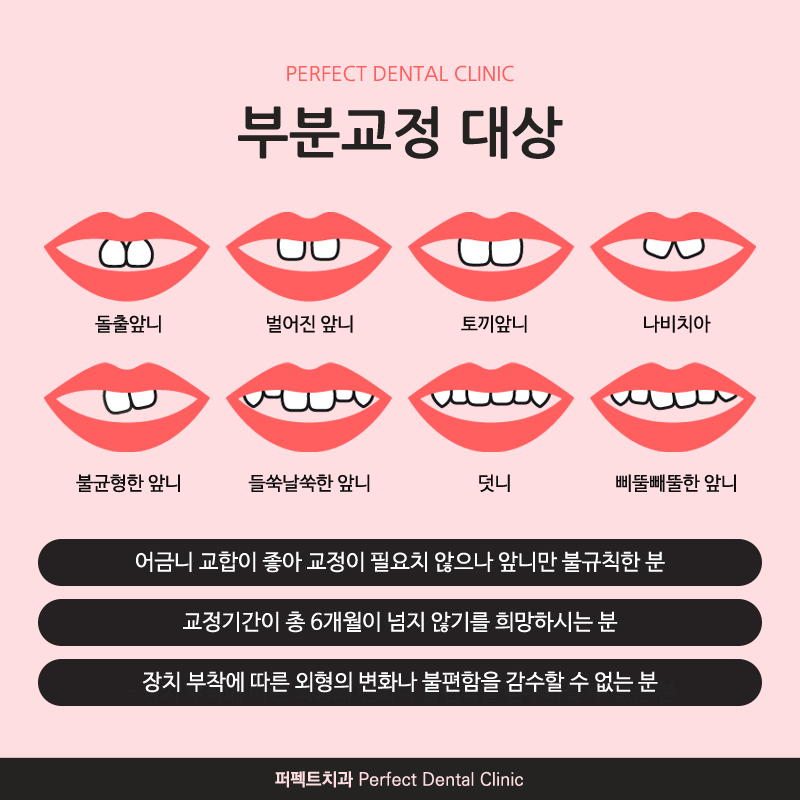 앞니부분교정만 따로 할 수 있나요? 관련 이미지 2