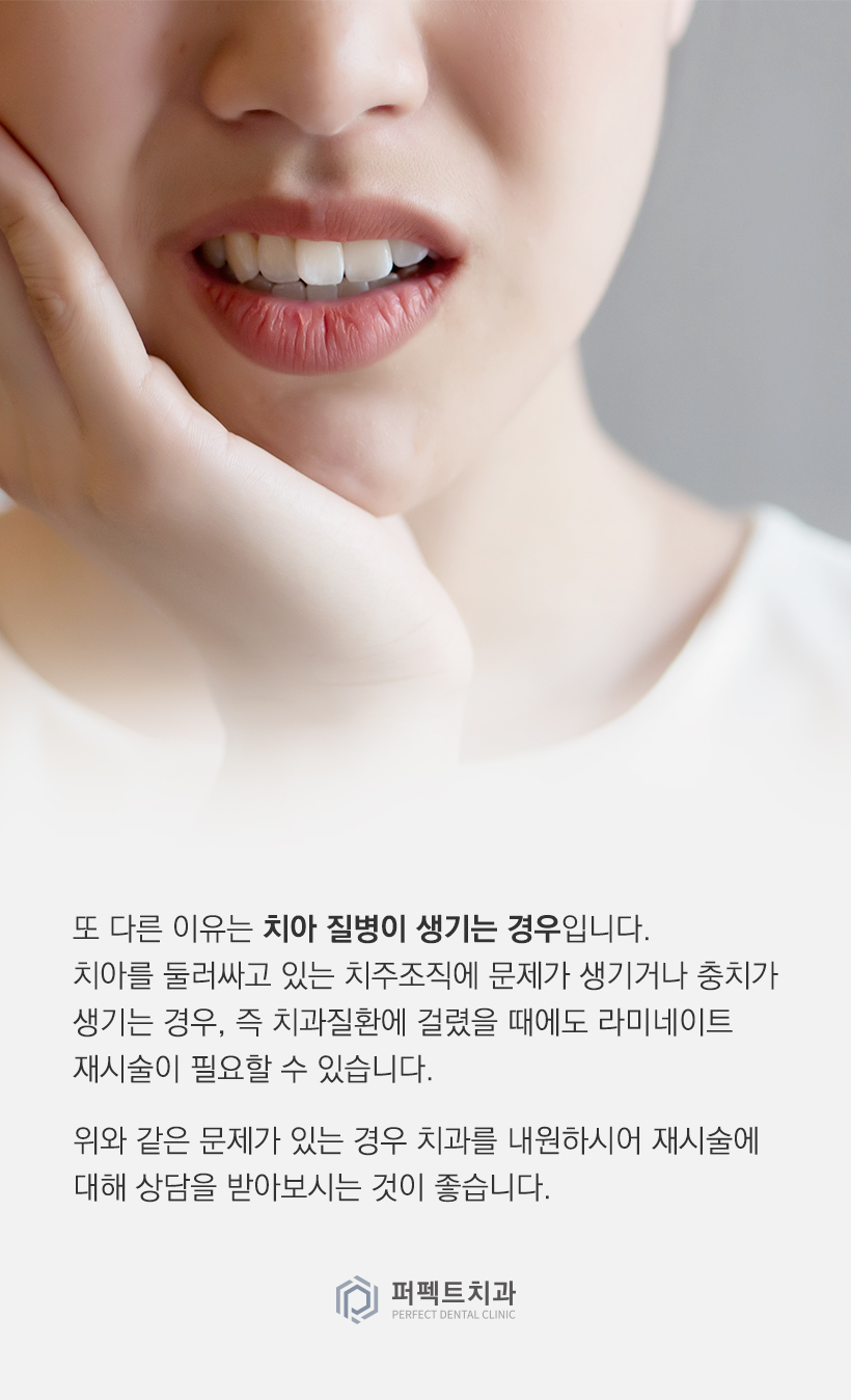 라미네이트 재시술을 하게 되는 이유는? 관련 이미지 3
