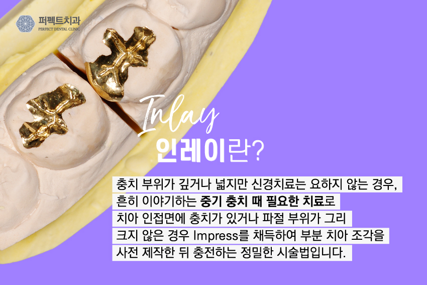 부담없는 충치치료가격 충치DAY로~&hearts; 관련 이미지 6