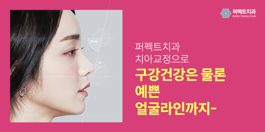 벌어진 앞니, 간단한 교정치료 관련 이미지 5