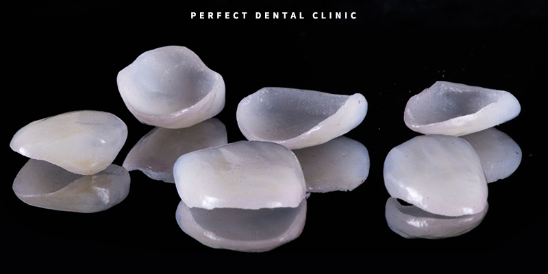 라미네이트, 올세라믹 차이점 관련 이미지 1