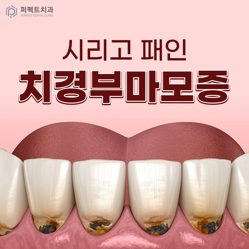 시린 이 치경부 마모증 비용 관련 이미지 1