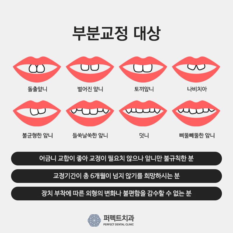 3개월 단기교정 비용과 기간은? 관련 이미지 5