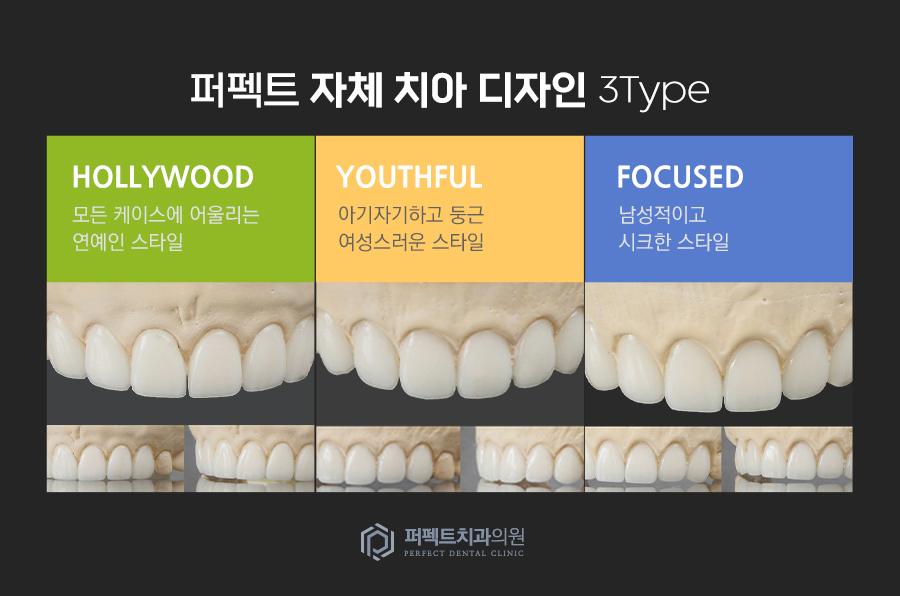 라미네이트 치료 시 참고사항은? 관련 이미지 6