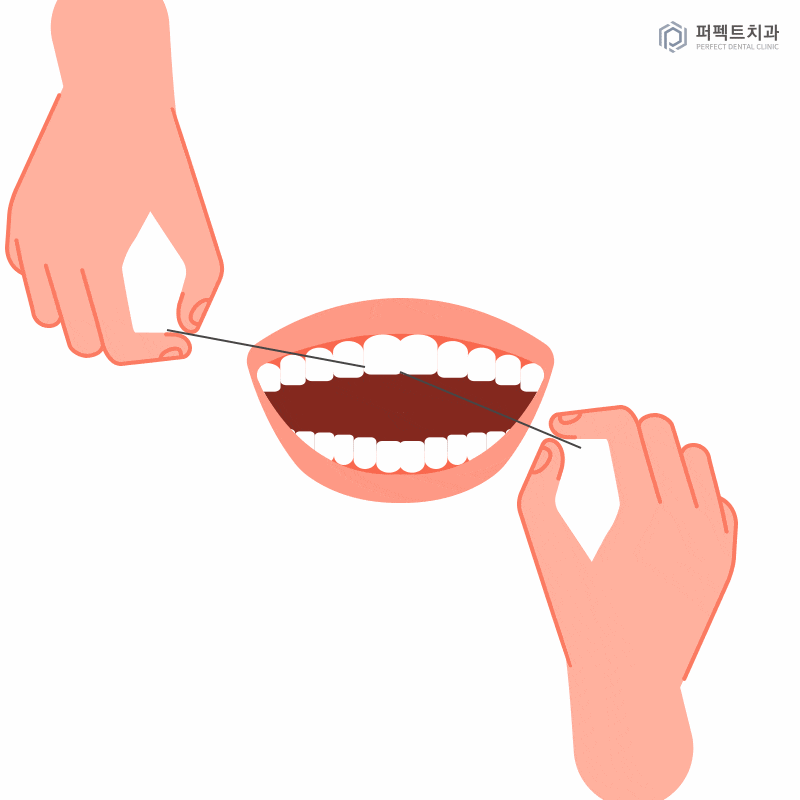라미네이트 후 치실 사용방법은? 관련 이미지 2