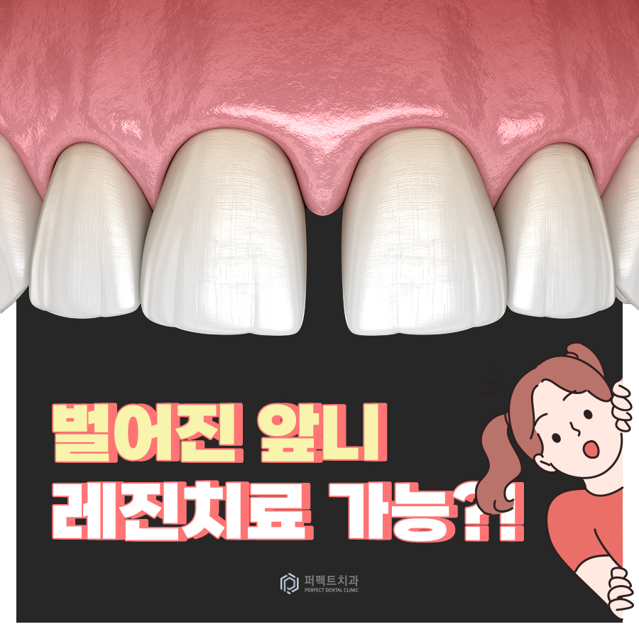 벌어진 앞니, 레진으로 치료 가능? 관련 이미지 1