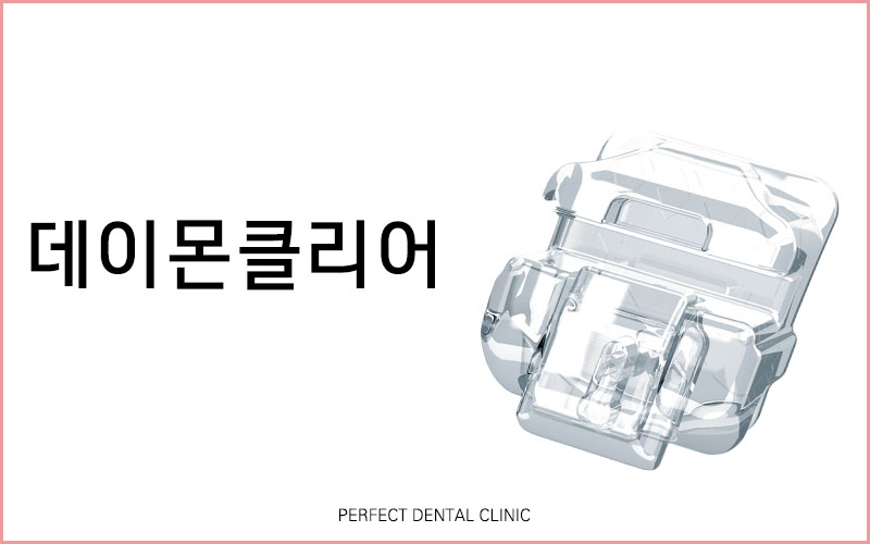 클리피씨 교정 급하다면?! 관련 이미지 3