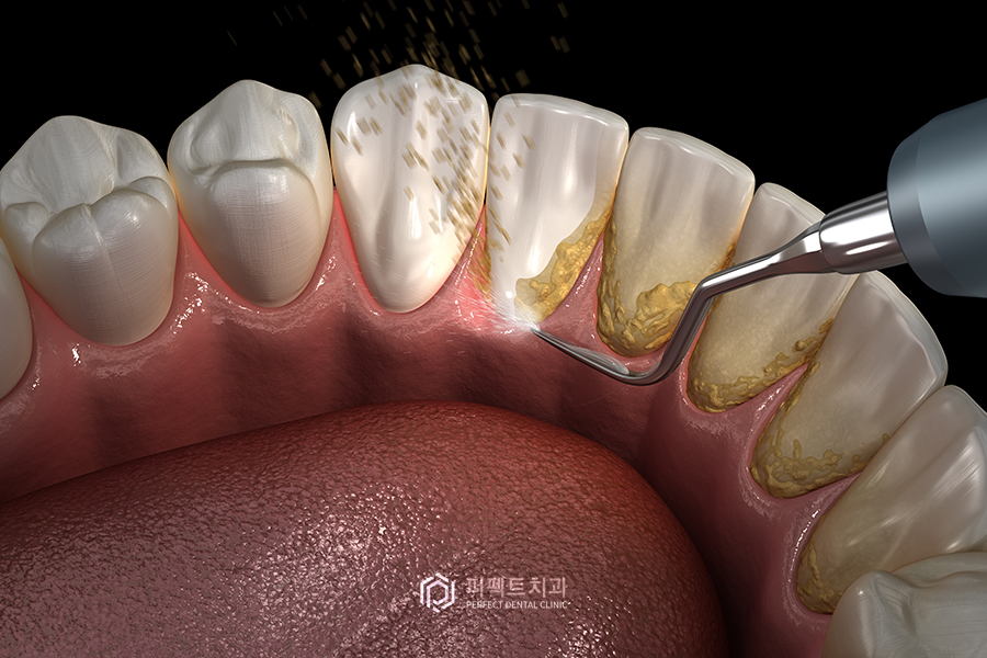 ①스케일링을 해야하는 이유는? 관련 이미지 1