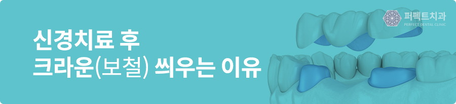치아에 씌운 크라운 보철, 이런 경우 크라운교체가 필요하다! 관련 이미지 4