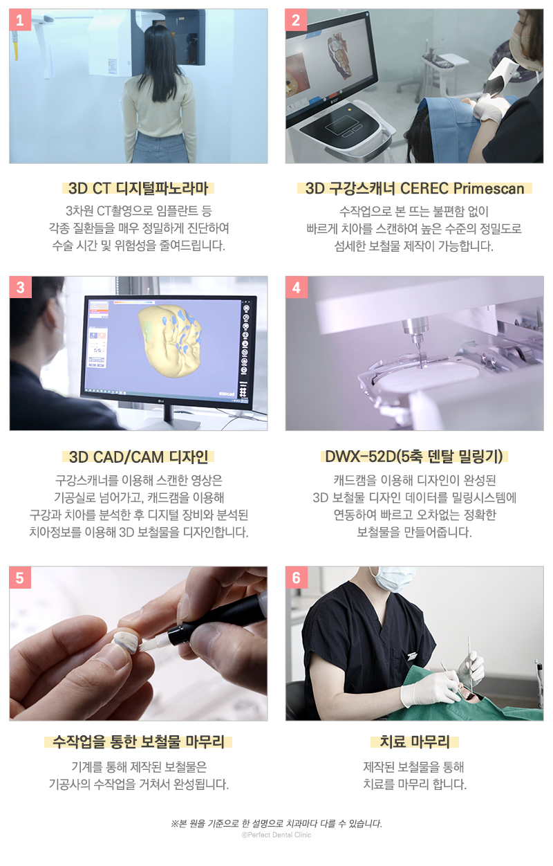 컴퓨터 분석을 통한 임플란트 관련 이미지 11