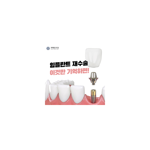 임플란트 재수술, 도대체 무엇이 잘못되었길래 관련 이미지 5