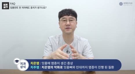 임플란트 충치 생길까? 관련 이미지 5