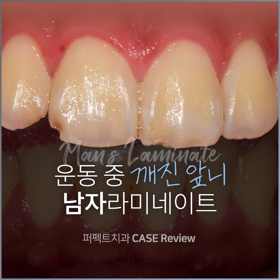 남자라미네이트, 더 오래 사용하려면? 관련 이미지 10