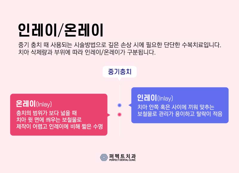 강남치과 충치 인레이 비용 관련 이미지 2