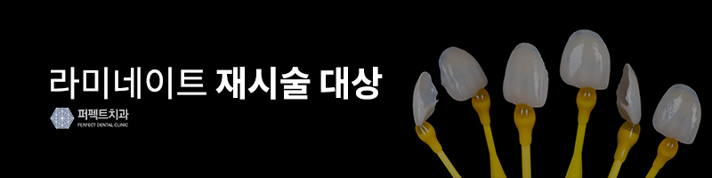 0.1mm 최소삭제, 앞니 라미네이트 후기 관련 이미지 4