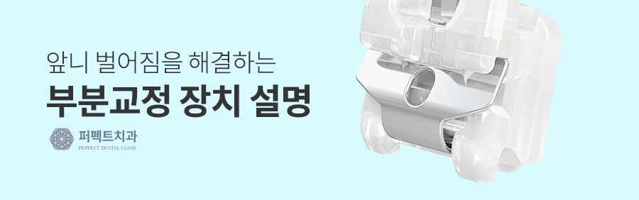 벌어진 앞니, 간단한 교정치료 관련 이미지 4