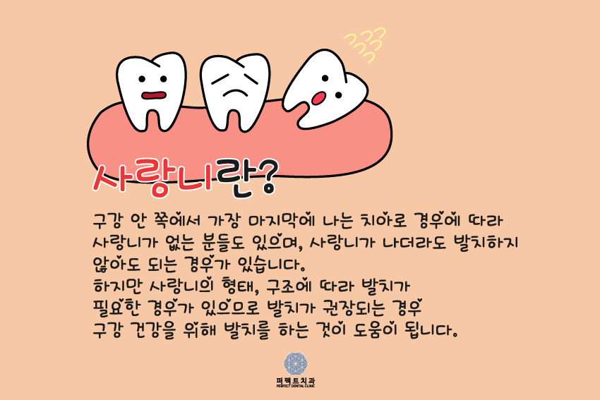 사랑니 뽑아야 되는데 아플까?ㅠㅠ 관련 이미지 2