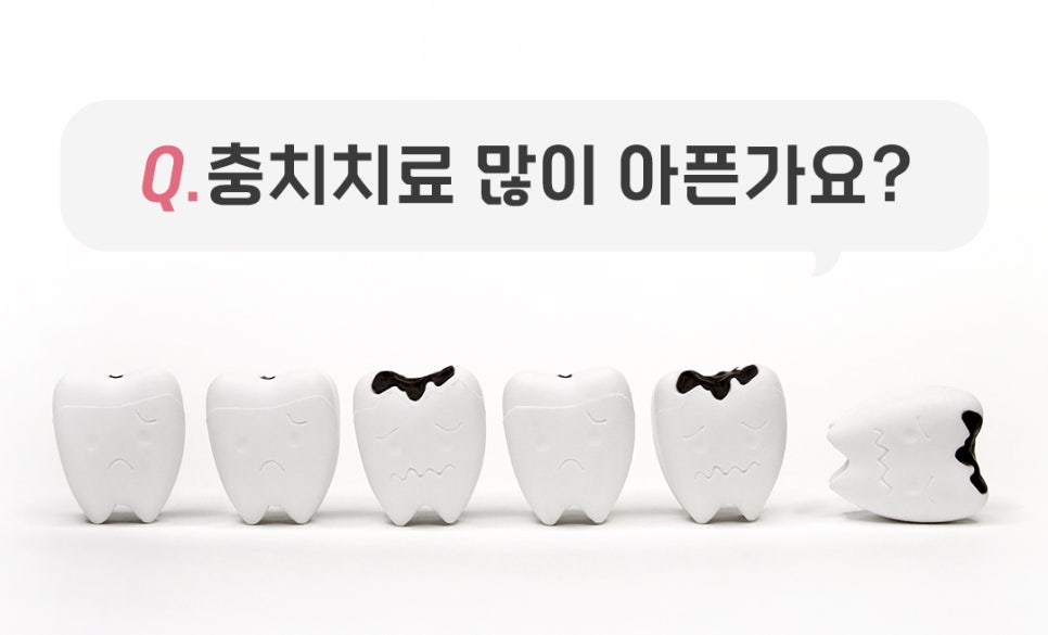 충치치료 많이 아픈가요? 관련 이미지 2