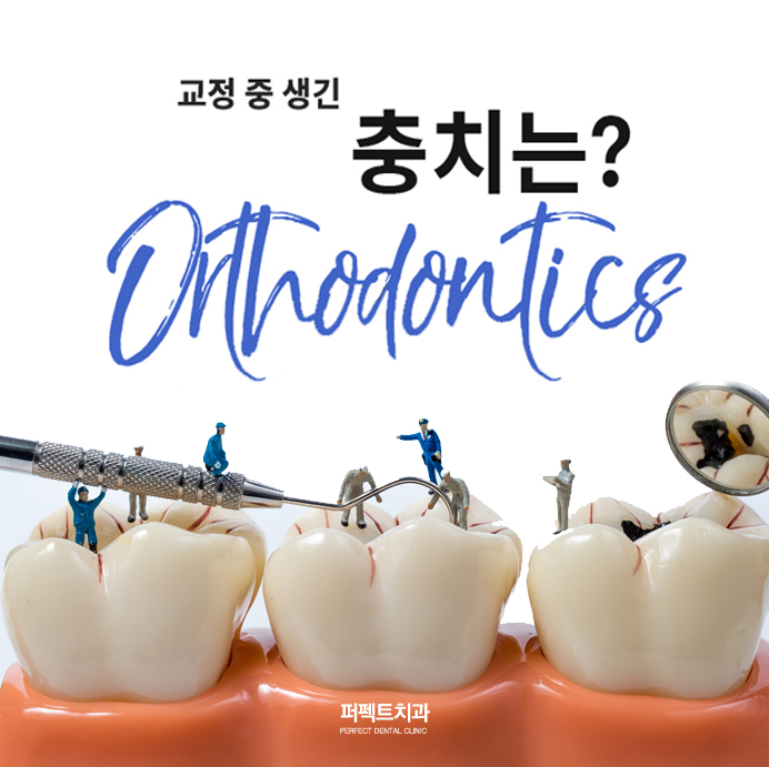 교정 중 생긴 충치, 치료할 수 있을까? 관련 이미지 1