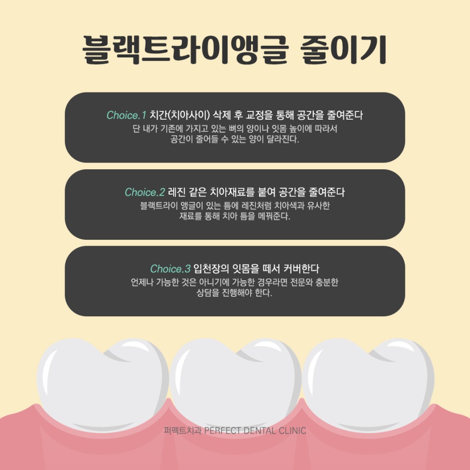 치아교정을 하면 꼭 블랙트라이앵글이 생기나요? 관련 이미지 4