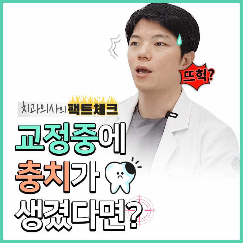 치아교정 중 충치치료 가능? 관련 이미지 1