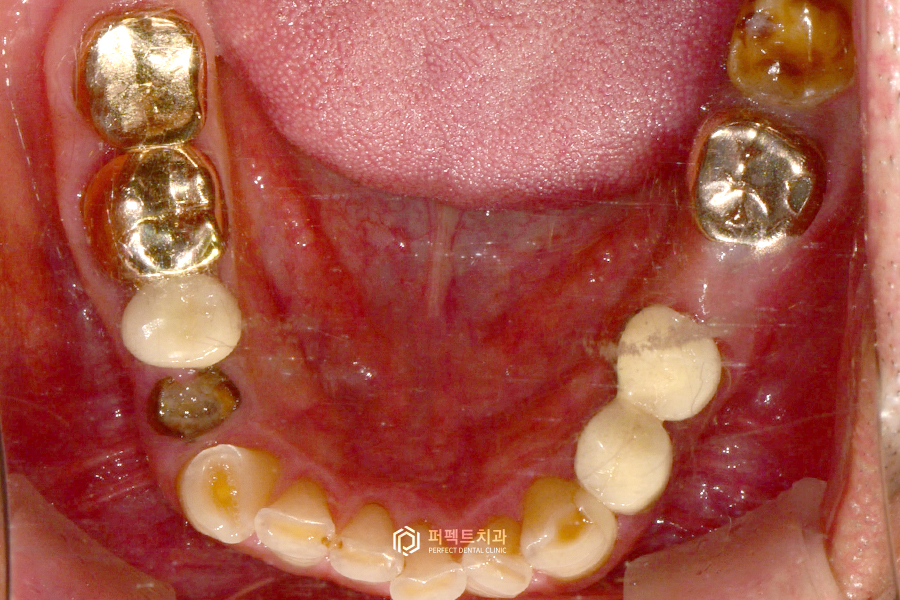 어금니가 없어 앞니로 음식을 드셨던..😰 어떻게 변했을까? 관련 이미지 12