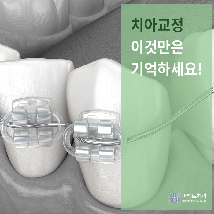 치아교정, 그것이 알고싶다! [환자들이 생각하는 흔한 오해] 관련 이미지 1