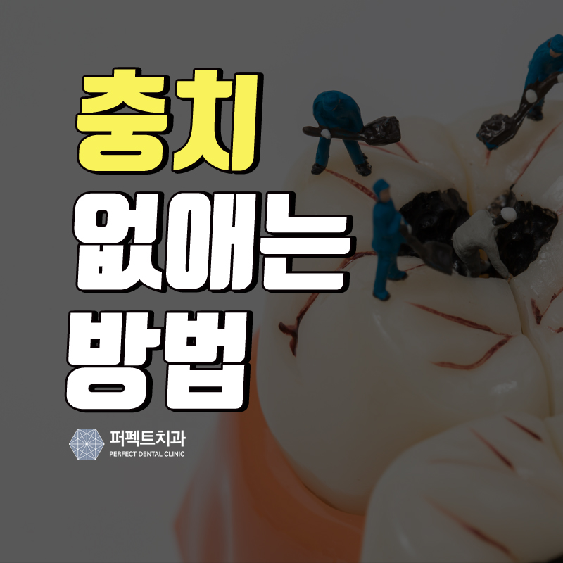 충치 없애는법, 충치DAY 진행중~! 관련 이미지 1