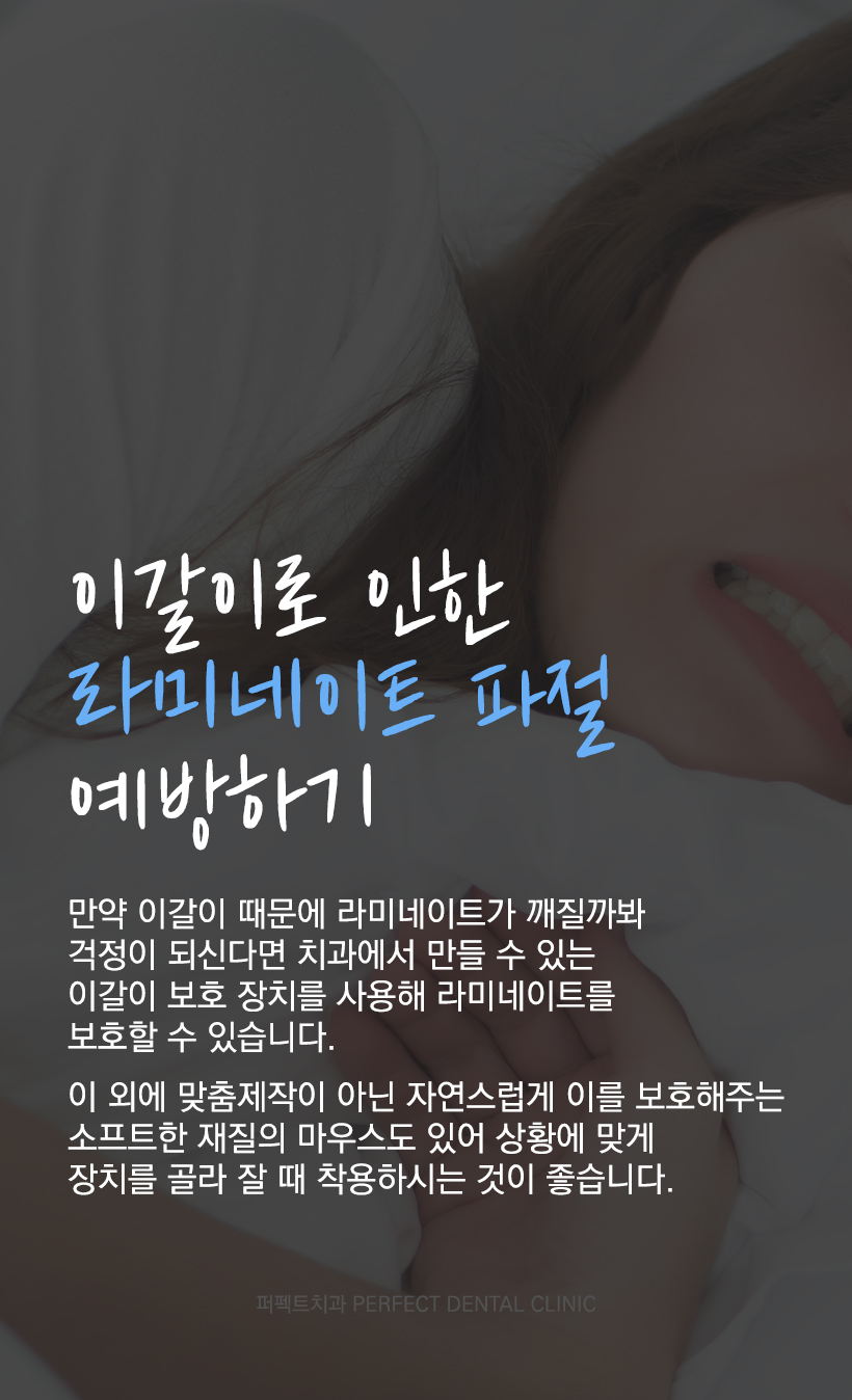 이갈이 하는데 라미네이트 가능한가요? 관련 이미지 5